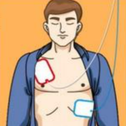 除颤仪什么时候用正确使用自动体外除颤仪，及时挽救更多人的生命！_https://www.jmylbn.com_新闻资讯_第7张