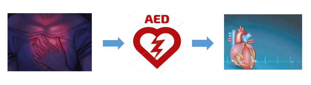 除颤仪什么时候用正确使用自动体外除颤仪，及时挽救更多人的生命！_https://www.jmylbn.com_新闻资讯_第2张