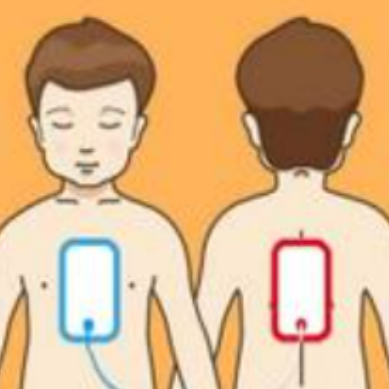 除颤仪什么时候用正确使用自动体外除颤仪，及时挽救更多人的生命！_https://www.jmylbn.com_新闻资讯_第8张