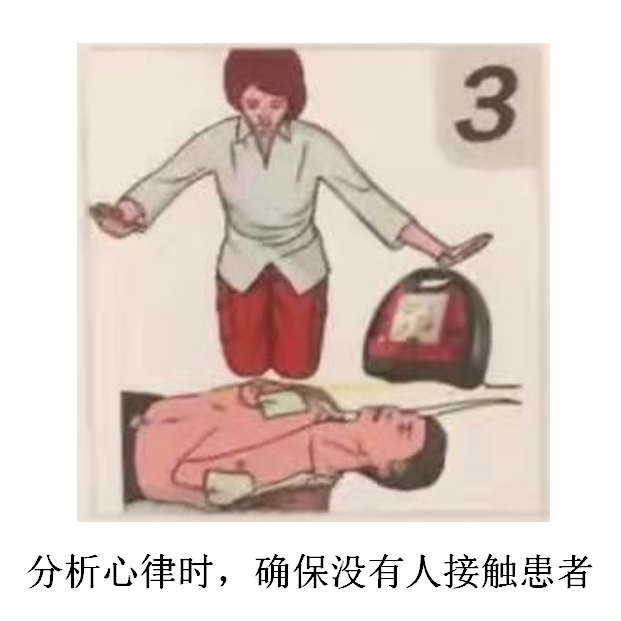除颤仪什么时候用正确使用自动体外除颤仪，及时挽救更多人的生命！_https://www.jmylbn.com_新闻资讯_第5张