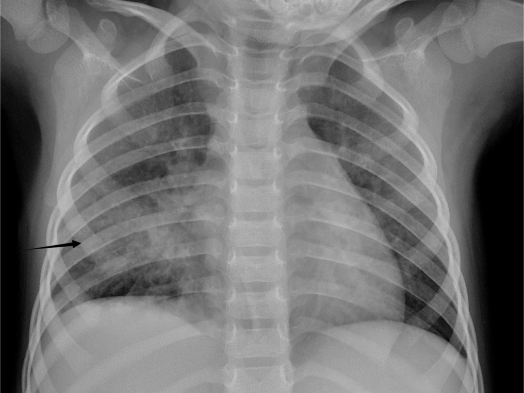 错付了！香蕉居然有辐射，200 根 = 拍一次胸片？