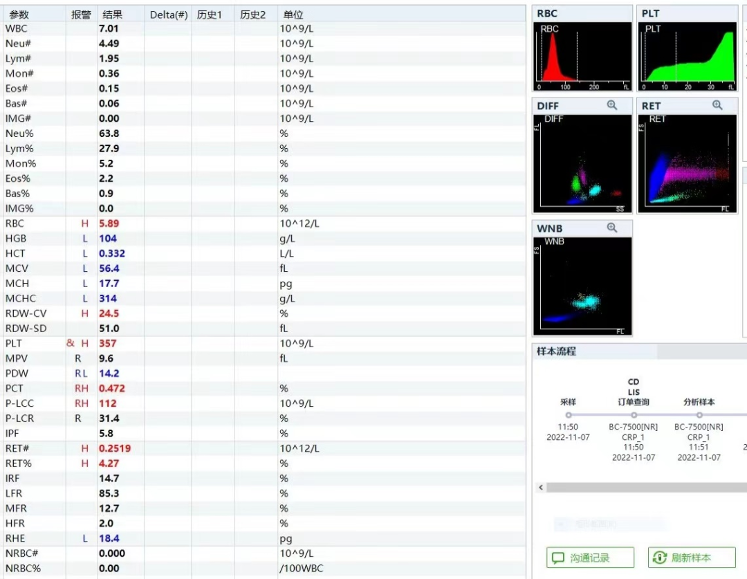 rbc直方图怎么看提示RBC碎片？血片镜检一探究竟_https://www.jmylbn.com_新闻资讯_第9张