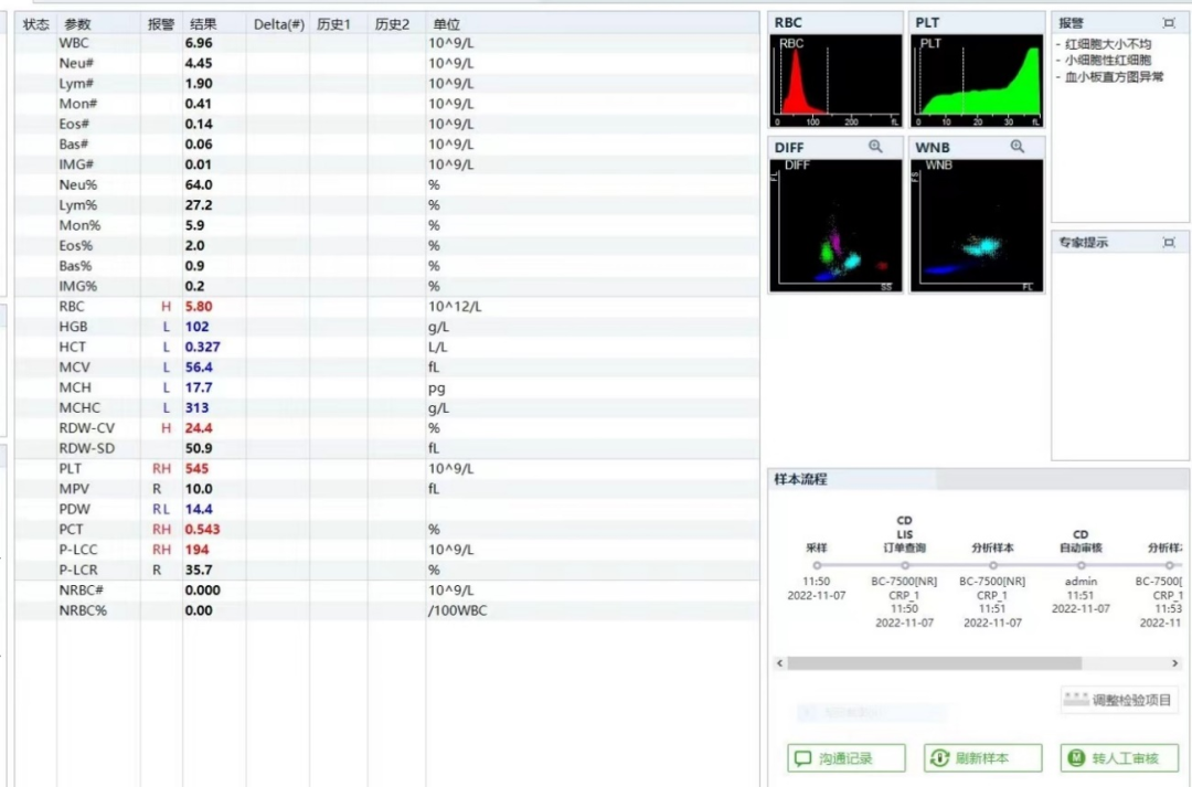 rbc直方图怎么看提示RBC碎片？血片镜检一探究竟_https://www.jmylbn.com_新闻资讯_第4张