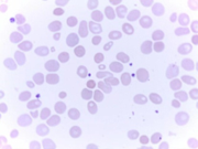 rbc直方图怎么看提示RBC碎片？血片镜检一探究竟_https://www.jmylbn.com_新闻资讯_第8张