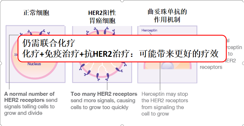 這類胃癌更易復發，聯合化療療效更佳丨胃愛喝彩 健康 第4張