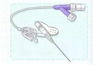 为什么要用动脉留置针【科普】手术“针”的不一样_https://www.jmylbn.com_新闻资讯_第7张