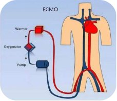act什么监测项目活化凝血时间（ACT）在体外膜肺氧合（ECMO）的临床应用-上海聚慕医疗器械有限公司
