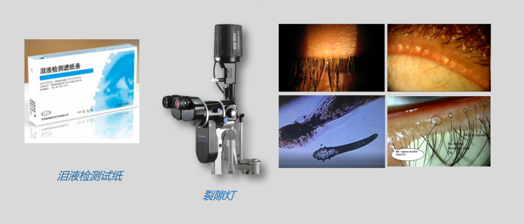 超声雾化器治疗什么病干眼超声雾化器，眼镜门店升级增益利器！_https://www.jmylbn.com_新闻资讯_第21张