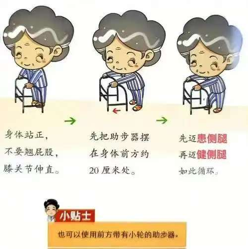 怎么用助行器助“行”有道——助行器使用全攻略   让每一步都安全稳健_https://www.jmylbn.com_新闻资讯_第5张