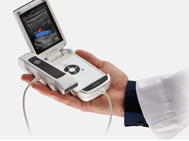 索诺星超声怎么样手机变超声，掌上超声百家争鸣：GE、飞利浦、飞依诺..._https://www.jmylbn.com_新闻资讯_第3张