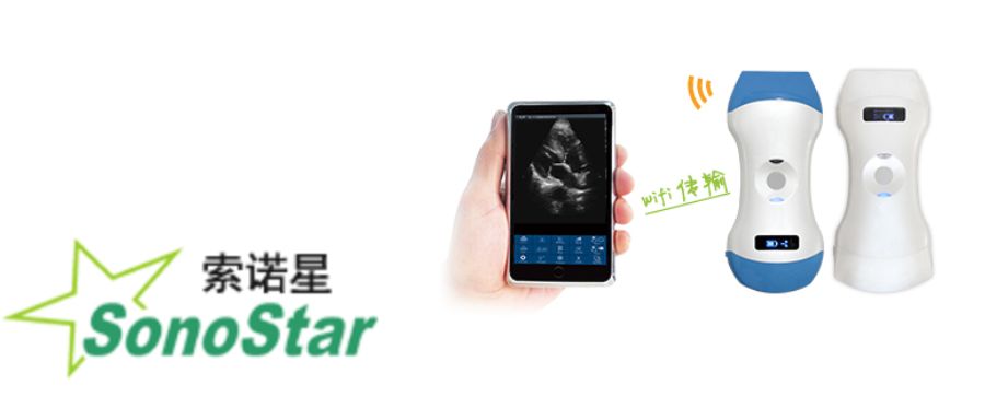 索诺星超声怎么样手机变超声，掌上超声百家争鸣：GE、飞利浦、飞依诺..._https://www.jmylbn.com_新闻资讯_第8张