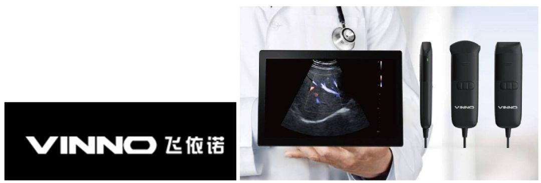 索诺星超声怎么样手机变超声，掌上超声百家争鸣：GE、飞利浦、飞依诺..._https://www.jmylbn.com_新闻资讯_第6张