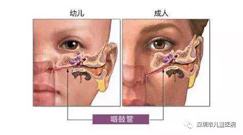 5歲娃差點送命！90%的家長不知道！兒科醫生：孩子感冒後易得這病... 健康 第7張