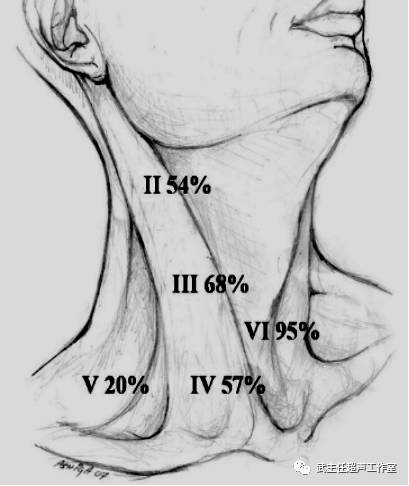 如何判断是否发生甲状腺癌淋巴结转移 一
