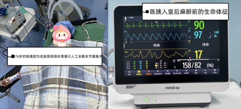 喉罩是什么【科普】喉罩—麻醉科的利器_https://www.jmylbn.com_新闻资讯_第2张