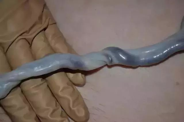 为什么剪脐带要先夹住新生儿是怎么剪断脐带？剪脐带时宝宝疼不疼？可能和你想的不一样_https://www.jmylbn.com_新闻资讯_第6张