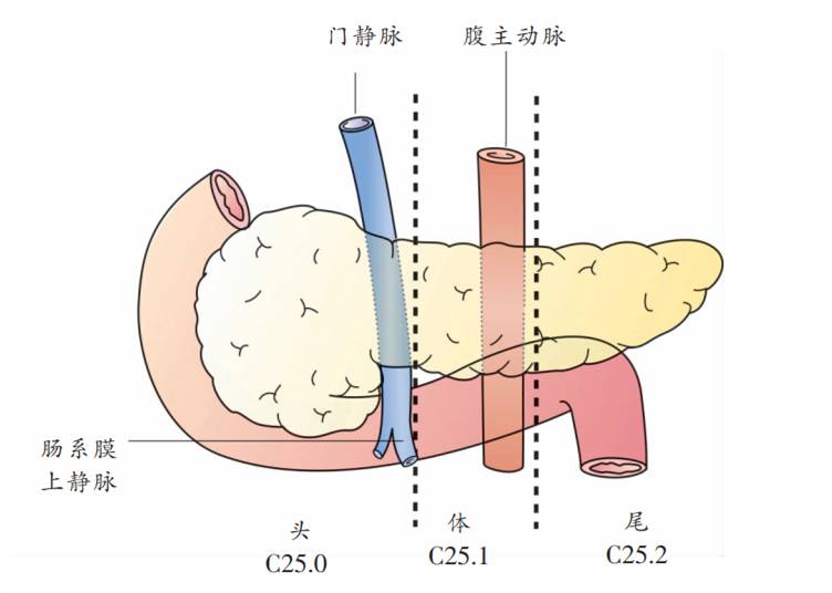 武汉市第六医院tomo中心胰腺肿瘤tnm分期完整解析