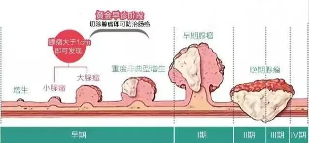 胃腸息肉是怎麼長出來的？有什麼危害？如何預防和治療？ 健康 第3張