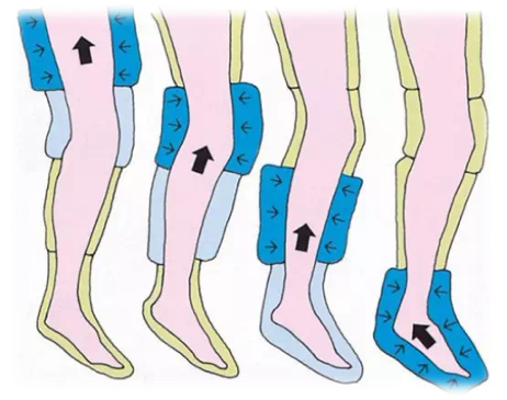 气压治疗仪怎么消毒【健康科普】气压治疗仪的适应症和禁忌证_https://www.jmylbn.com_新闻资讯_第9张