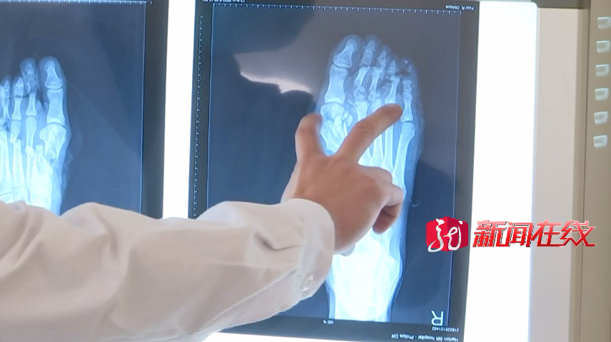 哈尔滨 三吨钢板空中落下，重重地砸在他的脚上！