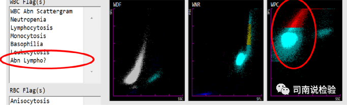 血常规用什么仪器检查血常规检验 - 白细胞散点图（上）_https://www.jmylbn.com_新闻资讯_第14张