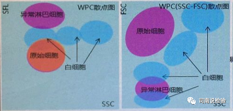 血常规用什么仪器检查血常规检验 - 白细胞散点图（上）_https://www.jmylbn.com_新闻资讯_第6张