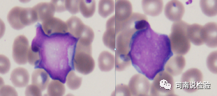 血常规用什么仪器检查血常规检验 - 白细胞散点图（上）_https://www.jmylbn.com_新闻资讯_第11张