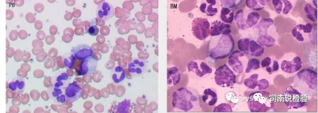 血常规用什么仪器检查血常规检验 - 白细胞散点图（上）_https://www.jmylbn.com_新闻资讯_第18张