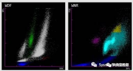 血常规用什么仪器检查血常规检验 - 白细胞散点图（上）_https://www.jmylbn.com_新闻资讯_第17张