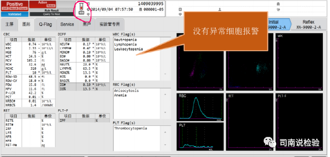 血常规用什么仪器检查血常规检验 - 白细胞散点图（上）_https://www.jmylbn.com_新闻资讯_第19张