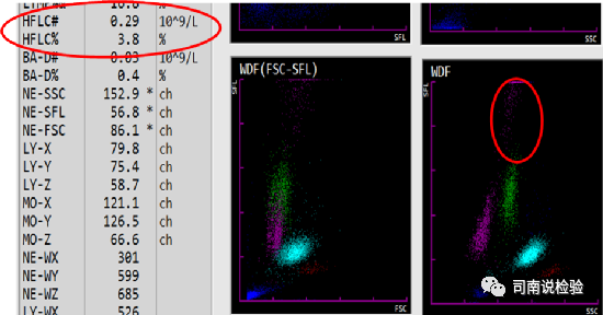 血常规用什么仪器检查血常规检验 - 白细胞散点图（上）_https://www.jmylbn.com_新闻资讯_第10张
