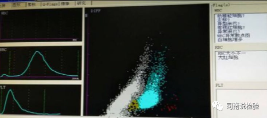 血常规用什么仪器检查血常规检验 - 白细胞散点图（上）_https://www.jmylbn.com_新闻资讯_第22张
