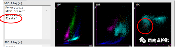血常规用什么仪器检查血常规检验 - 白细胞散点图（上）_https://www.jmylbn.com_新闻资讯_第13张