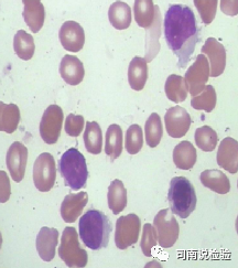血常规用什么仪器检查血常规检验 - 白细胞散点图（上）_https://www.jmylbn.com_新闻资讯_第15张