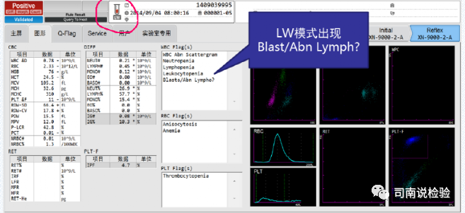 血常规用什么仪器检查血常规检验 - 白细胞散点图（上）_https://www.jmylbn.com_新闻资讯_第20张