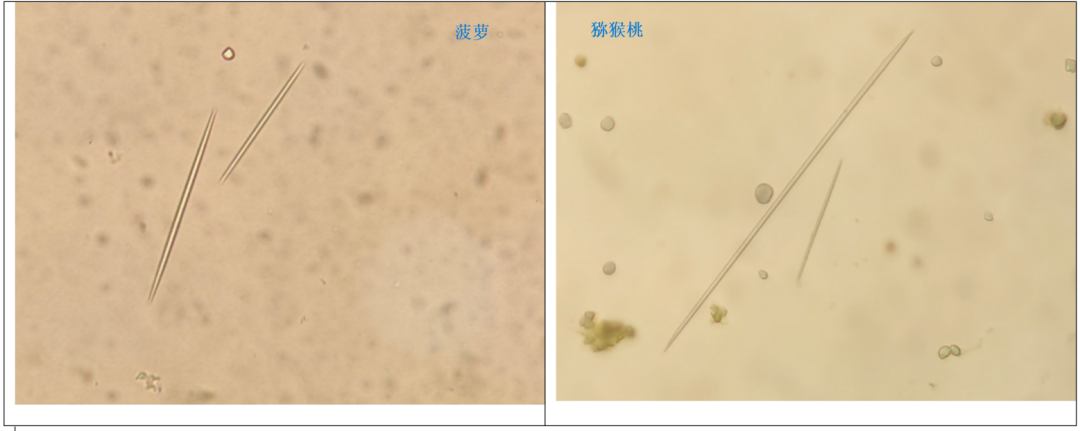 粪便常规仪器怎么用形态学138：粪便-夏科雷登结晶（仪器辅助判断）_https://www.jmylbn.com_新闻资讯_第8张