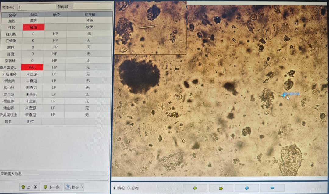 粪便常规仪器怎么用形态学138：粪便-夏科雷登结晶（仪器辅助判断）_https://www.jmylbn.com_新闻资讯_第4张