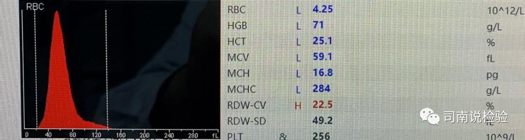 rbc直方图怎么看知识点058：说说红细胞直方图_https://www.jmylbn.com_新闻资讯_第5张