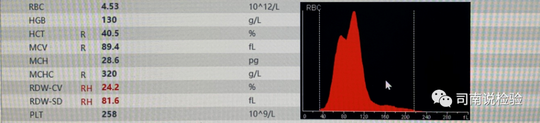 rbc直方图怎么看知识点058：说说红细胞直方图_https://www.jmylbn.com_新闻资讯_第14张
