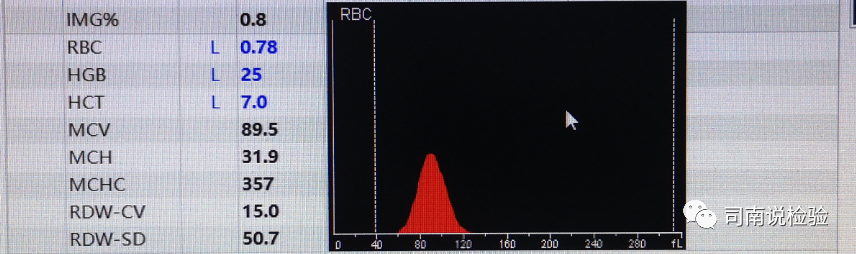 rbc直方图怎么看知识点058：说说红细胞直方图_https://www.jmylbn.com_新闻资讯_第12张