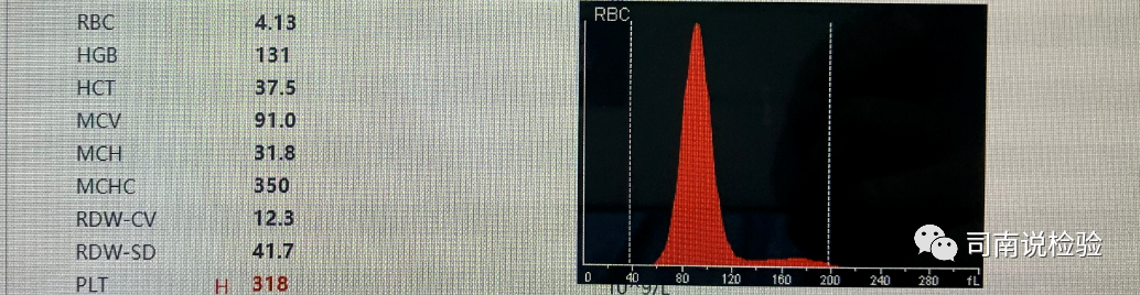 rbc直方图怎么看知识点058：说说红细胞直方图_https://www.jmylbn.com_新闻资讯_第3张