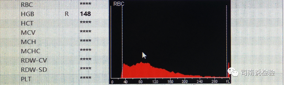 rbc直方图怎么看知识点058：说说红细胞直方图_https://www.jmylbn.com_新闻资讯_第22张