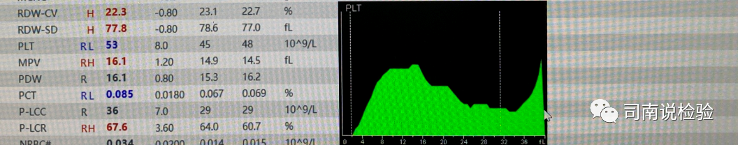 rbc直方图怎么看知识点058：说说红细胞直方图_https://www.jmylbn.com_新闻资讯_第27张