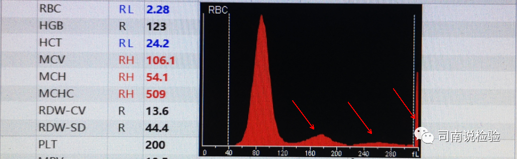 rbc直方图怎么看知识点058：说说红细胞直方图_https://www.jmylbn.com_新闻资讯_第31张