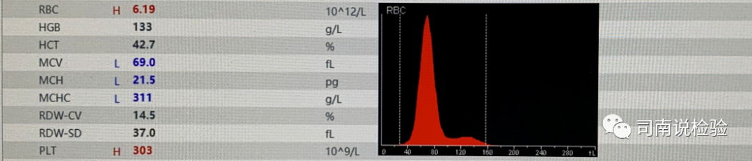 rbc直方图怎么看知识点058：说说红细胞直方图_https://www.jmylbn.com_新闻资讯_第7张