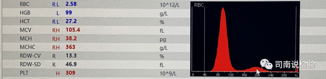 rbc直方图怎么看知识点058：说说红细胞直方图_https://www.jmylbn.com_新闻资讯_第16张