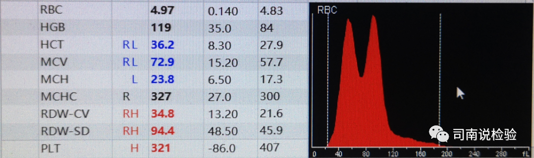 rbc直方图怎么看知识点058：说说红细胞直方图_https://www.jmylbn.com_新闻资讯_第9张