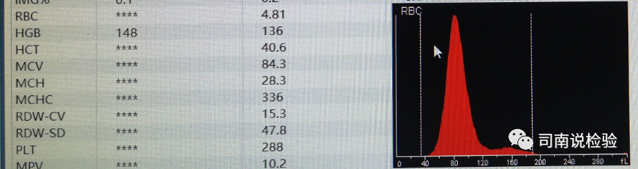 rbc直方图怎么看知识点058：说说红细胞直方图_https://www.jmylbn.com_新闻资讯_第23张