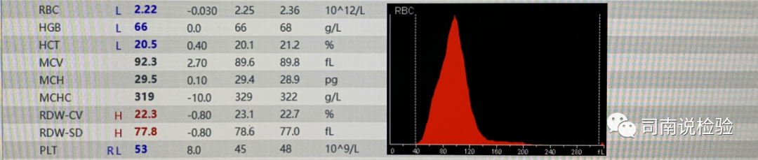 rbc直方图怎么看知识点058：说说红细胞直方图_https://www.jmylbn.com_新闻资讯_第28张