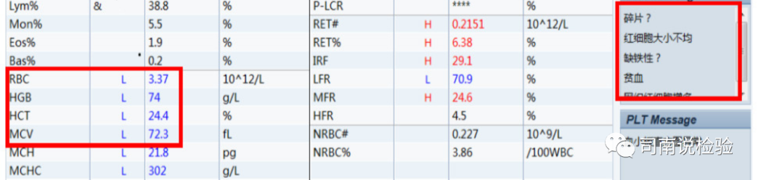 rbc直方图怎么看知识点058：说说红细胞直方图_https://www.jmylbn.com_新闻资讯_第19张